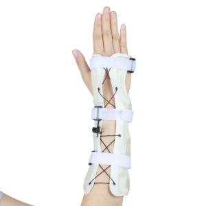 <span class=keywords><strong>Attelle</strong></span> médicale pour main et <span class=keywords><strong>poignet</strong></span>, immobilisateur de main et de <span class=keywords><strong>poignet</strong></span> à durcissement à la lumière - Product Image 4