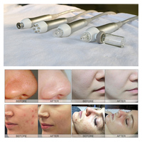 Huidverzorgingsapparatuur schoonheidssalon Hydradermabrasie Zuurstof Jet Multifunctionele gezichtsmachine voor het verwijderen van mee-eters gezichtsreiniging