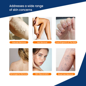 CE 승인 Picolaser 기계 독점 새로운 긴 펄스 1064nm ND YAG 및 755nm 파장 문신 및 제모 레이저 - Product Image 3