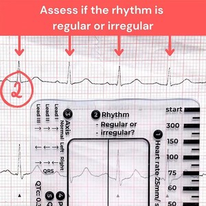 Règle de mesure <span class=keywords><strong>ECG</strong></span> à 7 étapes pour l'interprétation, outil de mesure en plastique transparent, rapporteur EKG, référence pour les infirmières - Product Image 3
