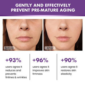 Luxury <strong>Snake</strong> <strong>Venom</strong> Peptide <strong>Eye</strong> <strong>Cream</strong> Anti Wrinkle Lifting Firming Anti Aging Skin Remove Dark Circle Age Defying <strong>Eye</strong> <strong>Creams</strong> - Product Image 3