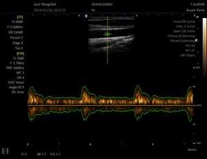 Échographe vétérinaire 3D 4D portable avec écran HD pour cliniques et hôpitaux – Fournisseur médical - Product Image 2