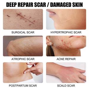 Crema Avanzada para Cicatrices, la Mejor Crema para Cicatrices Antiguas, Queloides y TKA, para Venta al por Menor - Product Image 5