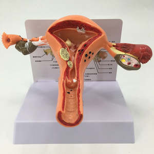 Modèle anatomique de l'utérus <span class=keywords><strong>humain</strong></span> en PVC de haute qualité, structure pathologique gynécologique, organes reproducteurs féminins pour l'enseignement CE/ISO - Product Image 3