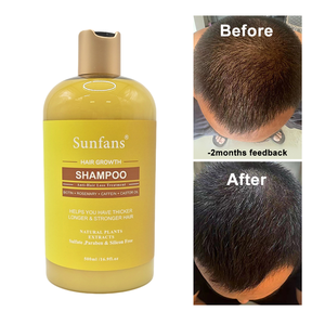 Piante naturali cura della crescita dei capelli Set <span class=keywords><strong>olio</strong></span> di ricino <span class=keywords><strong>e</strong></span> biotina Shampoo <span class=keywords><strong>e</strong></span> balsamo con menta piperita per la prevenzione della perdita di capelli - Product Image 5