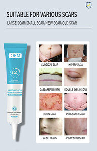 Gel Reparador de Cicatrizes de Acne Personalizado, Rápido e Eficaz com Ácido Salicílico para Redução de Poros, Creme de Uso Diário - Product Image 3