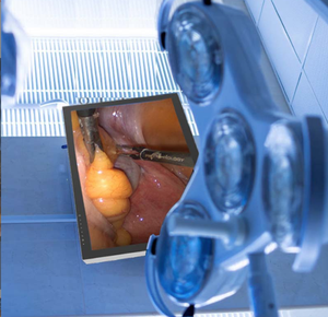 จอแสดงผลสำหรับการผ่าตัดแบบส่องกล้องคุณภาพสูง ขนาด 27 นิ้ว 32 นิ้ว 55 นิ้ว สำหรับใช้ในโรงพยาบาล เครื่องมือไฟฟ้า - Product Image 2