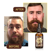 Kit d'huiles de croissance pour barbe hydratant et nourrissant de marque privée BARBERPASSION soin de la barbe pour hommes
