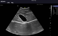 Échographe portable de diagnostic EDAN AX9 neuf et EDAN AX9 pour usage vétérinaire