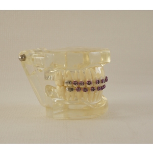 Modelo de ortodoncia dental transparente con soporte de metal - Product Image 3