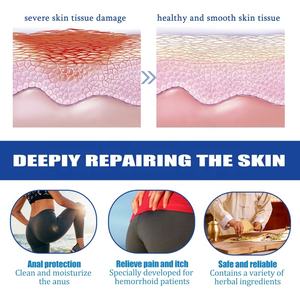 Produtos de Saúde por Atacado, Cápsulas Softgel para Hemorroidas - Product Image 5