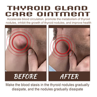 Pommade de soin de la glande thyroïde South Moon Nœuds lymphatiques Dragage des impuretés corporelles Expulsant les nodules thyroïdiens Pommade inhibitrice