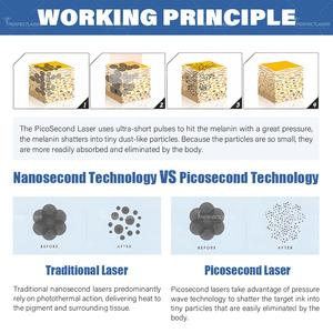 Beauty Salon sử dụng Nd Yag laser Loại bỏ hình xăm thiết bị xách tay Q Switched 4 sóng loại bỏ vết sẹo picosecond Laser Giá máy - Product Image 6