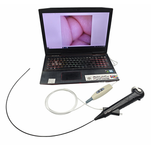 6.3FR 7.5FR HD Desechable Digital USB Urológico Endo Alcance para computadora portátil médica Video flexible Ureteroscopio médico - Product Image 1