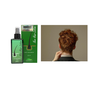 Loción con Aceite de Coco 100% Orgánico y Spray Capilar Herbal 120ml - Previene la Caída del Cabello y Refresca - Product Image 1