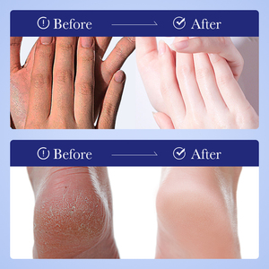 <span class=keywords><strong>Crema</strong></span> <span class=keywords><strong>Corpo</strong></span> Schiarente e Idratante all'<span class=keywords><strong>Urea</strong></span> OEM FAYANKOU, <span class=keywords><strong>Crema</strong></span> Viso Rivitalizzante e Nutriente, Etichetta Privata, Vendita all'Ingrosso - Product Image 4