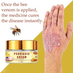 <span class=keywords><strong>Huile</strong></span> de théier au goudron de houille, soulagement des démangeaisons corporelles, des squames, de la peau sèche et gercée, traitement du <span class=keywords><strong>psoriasis</strong></span>, crème hydratante apaisante, crème topique anti - Product Image 3