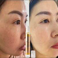 Offre Flash : Huile Réparatrice Visage Anti-Pigmentation, Nourrissante, Lissante et Éclaircissante pour la Peau