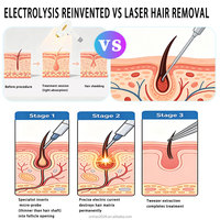 Appareil d'électrolyse professionnel unisexe pour l'épilation de la barbe masculine et des poils corporels féminins – Dispositif d'épilation par électrolyse – Franchise