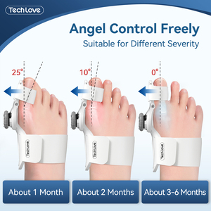 Perilla ajustable Tenicore, Corrector de Hallux Valgus, dispositivo preciso de tracción y corrección de alivio de alineación de dedos - Product Image 2