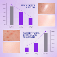 Mousse Nettoyante Coréenne Bio Végane au Bifida Ferment Lysate, Vitamine E et Niacinamide, Sans Parabène, Nettoyage Profond des Pores