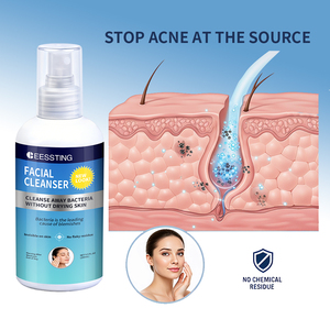 Nettoyant Quotidien Visage OEM/ODM Contrôle Sébum Exfoliant Peaux Mortes Resserre les Pores Élimine les Imperfections et les Éruptions Cutanées - Product Image 3