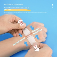 Réducteur de tension de plaie de pansement cutané Patch de cicatrice médicale Bandes steri Sangle élastique Type de fermeture éclair Bande de réduction de cicatrice sans couture