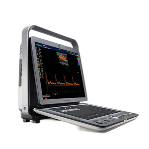 Système d'échographie vétérinaire diagnostique Sonoscape S9V Premium, réutilisable et durable, pour une pratique clinique exigeante - Product Image 2