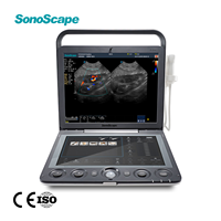 Ecógrafo Doppler Color SonoScape S9 S9V de 128 Canales, Escáner de Ultrasonido Portátil para Clínica Veterinaria, Hospital y Granja