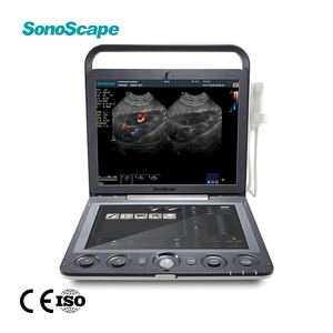 Ecógrafo Doppler Color Veterinario SonoScape S9V, Escáner Portátil de Alto Rendimiento para Uso Clínico, de Campo y Emergencias - Product Image 1