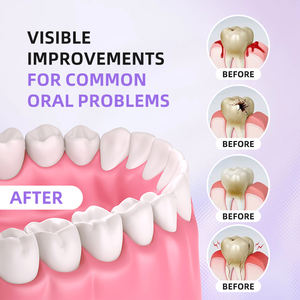 Enjuague Bucal Desechable para el Cuidado Bucal con Proteína de Matriz de Esmalte Recombinante Sialintide, Venta Directa de Fábrica, para Problemas Dentales - Product Image 2