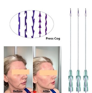 Fio Mono Liso de Alta Qualidade para Lifting de Olhos e Lábios com Fios <span class=keywords><strong>PDO</strong></span> e PCL de Fábrica - Product Image 6