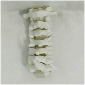 Modèle anatomique de la colonne cervicale C1 à C7 en mousse solide KyrenMed pour la pratique de la chirurgie orthopédique - Product Image 4