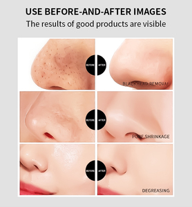 Bán buôn Hữu Cơ tinh khiết tự nhiên làm sạch sâu mũi lỗ chân lông Dải đầu đen Remover tấm mặt nạ đen mũi Dải các bản vá lỗi - Product Image 6
