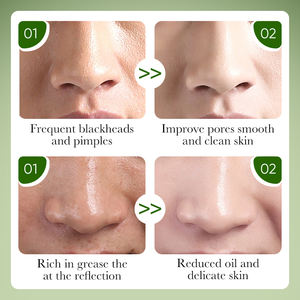 ZOZU Глубокая очистка пор T Zone уход за кожей бамбуковый уголь удаление черных точек угрей маска для носа Грязевая Маска Крем Набор сыворотки для лица - Product Image 6