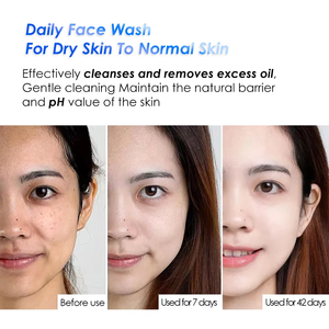 Limpiador <span class=keywords><strong>Facial</strong></span> de Bajo pH, Hidratante con Aminoácidos - Product Image 6