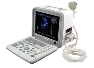 Mesin ultrasound laptop portabel & Murah hitam putih pemindai ultrasound mesin pemindai ultrasound resolusi tinggi - Product Image 6