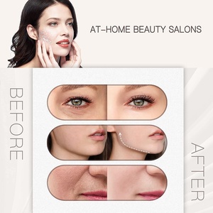 Máy Trị Liệu Da Mặt Tần Số Cao Thiết Bị Làm Đẹp Chăm Sóc Da Mặt Tại Nhà Khác - Product Image 4