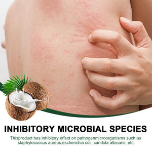 ครีมแก้คันส่วนผสมน้ำมันมะพร้าว 20 กรัม สำหรับการดูแลผิวและบรรเทาอาการคันผิวหนัง สำหรับใช้ทุกวัน - Product Image 3