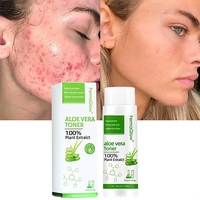 Tonique Hydratant Anti-Acné à l'Aloe Vera Fermenté pour le Contrôle du Sébum, les Boutons, les Pores et les Peaux Sensibles à Tendance Acnéique - Tonique Visage à l'Aloe Vera
