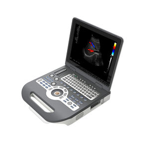 Escáner de Ultrasonido LTUB65, Máquina de Ultrasonido Doppler a Color 4D con <span class=keywords><strong>Precio</strong></span> Razonable, Sistema de Diagnóstico por Ultrasonido - Product Image 3