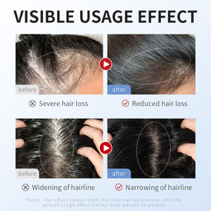 El mejor suero <span class=keywords><strong>de</strong></span> crecimiento <span class=keywords><strong>de</strong></span> <span class=keywords><strong>cabello</strong></span> a base <span class=keywords><strong>de</strong></span> hierbas para la pérdida <span class=keywords><strong>de</strong></span> <span class=keywords><strong>cabello</strong></span> promueve el desarrollo saludable del <span class=keywords><strong>cabello</strong></span> - Product Image 3