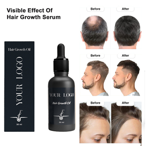 Sérum lissant pour cheveux à la kératine professionnel pour salon, réparation des dommages, <span class=keywords><strong>soin</strong></span> des cheveux, 1000 ml, traitement à la kératine protéinée - Product Image 6