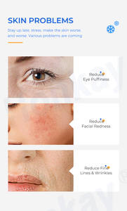 सबसे अधिक बिकने वाले उत्पाद 2024 त्वचा डॉक्टरों को रोलर बर्फ का सामना करना पड़ता है, अन्य हाथों और पैरों की देखभाल गुलाबी बर्फ रोलर - Product Image 5