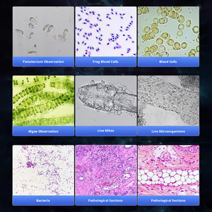 <span class=keywords><strong>Microscope</strong></span> numérique trinoculaire vétérinaire avec moniteur LCD HD et objectifs multiples pour l'échantillonnage de <span class=keywords><strong>sang</strong></span>, de sperme et de tissus animaux - Product Image 6