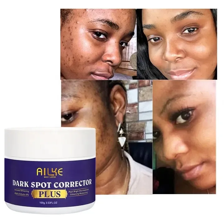Ailke Neue Produkte White ning Range Aufhellung Körper Hautpflege Dunkle Flecken Behandlung Feuchtigkeit creme Gesichts creme für Frauen