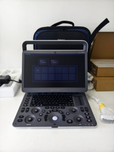 Ecógrafo Doppler Color Sonoscape E1exp, Portátil 4D, para Fisioterapia, Uso Vascular, Ginecología/Obstetricia y Cardiología - Product Image 5