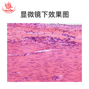 El tejido muscular, las células musculares lisas (secciones longitudinales y transversales), son los componentes del movimiento del cuerpo humano. - Product Image 4