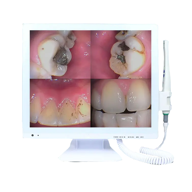 2022 नई इंट्रा मौखिक कैमरा के साथ काम दंत Intraoral कैमरा के लिए 17 इंच एलसीडी मॉनिटर डेंटल यूनिट कुर्सी