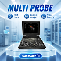 Vente en gros - Promotion exceptionnelle : Échographe Doppler Couleur Portable avec options de sondes Convexe et Linéaire pour usage Commercial et Domestique